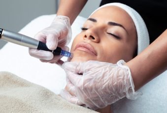 Mesotherapy treatment