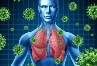 Disease attacking lungs
